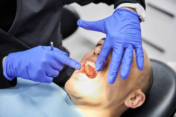 Best Emergency Tooth Extraction in Laurium, MI
