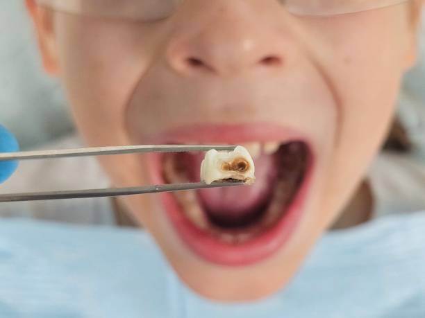 Best Pediatric Emergency Dentist in Laurium, MI