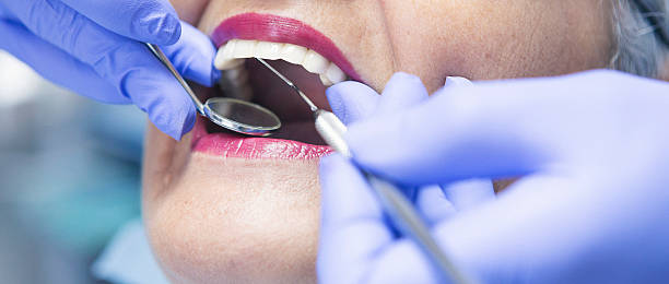 Best Emergency Treatment for Dental Infections or Abscesses in Laurium, MI